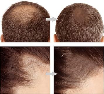 2in1 Hairline &amp; Eyebrow Shaping Stamp View Gallery - Pakistan