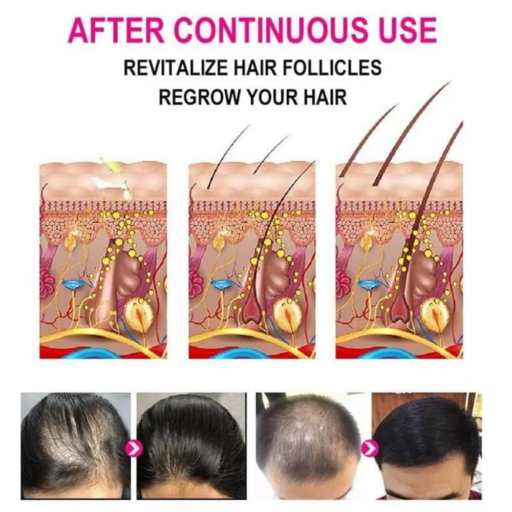 Anti-Grey Hair Serum, 30Ml View Gallery - Pakistan