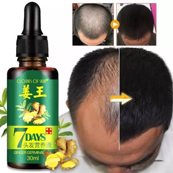 original 7 Days Hair Growth Germinal Serum Oil (30ML)