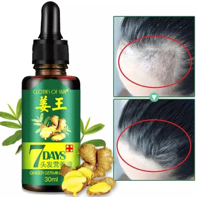 original 7 Days Hair Growth Germinal Serum Oil (30ML) View Gallery - Pakistan
