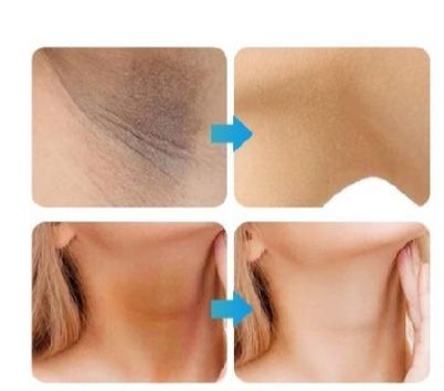 Whitening Cream for sensitive Areas underarm and private Areas - 30g View Gallery - Pakistan