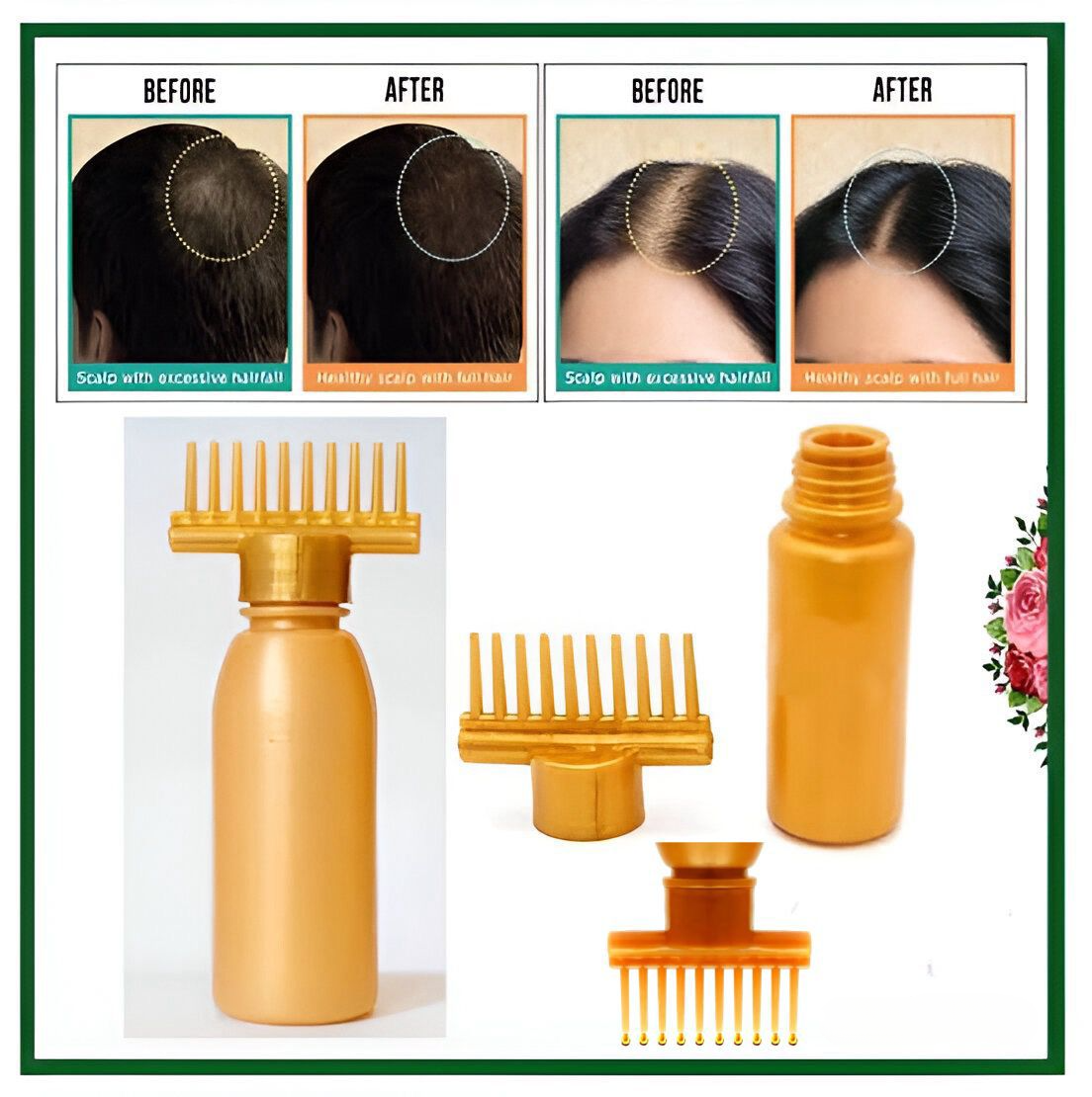 (Pack of 20) Hair dye bottle | Hair Oil Applicator Bottle, Root oiling Comb bottle for Hair Coloring, Shampoo, Oiling, Dye, and Scalp Treatment for home &amp; commercial ( Empty Bottle) View Gallery - Pakistan