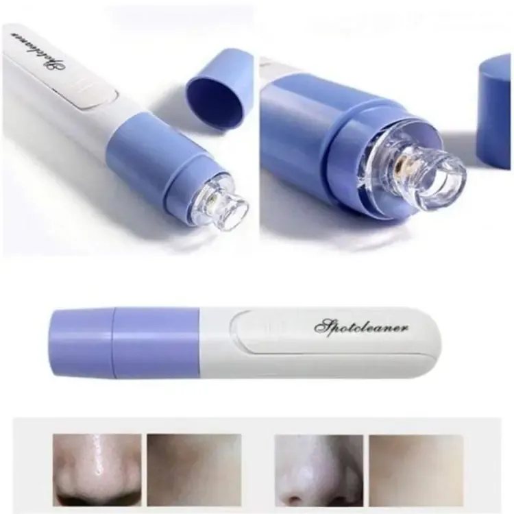 New Electric Blackhead Remover Sucker Black Head Pimple Pore Cleaner Vacuum Blackhead Remover Pore Cleaner (Random color) View Gallery - Pakistan