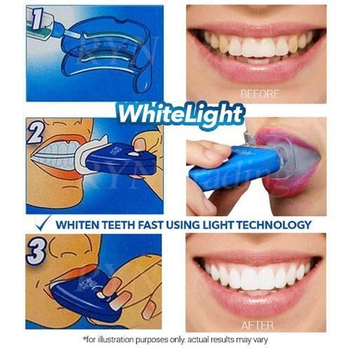 White Light Teeth Whitening Brightener | No box card packing  and cell operated. View Gallery - Pakistan