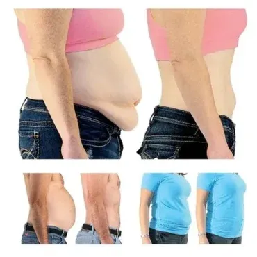 Tummy Tuck Miracle Slimming System Kit View Gallery - Pakistan