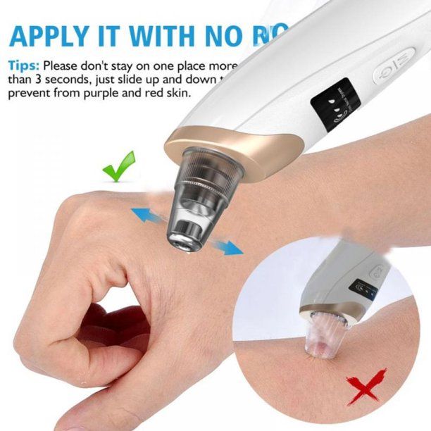 Electric Suction Blackhead Instrument Home Beauty Instrument Blackhead Pore Cleaning. View Gallery - Pakistan
