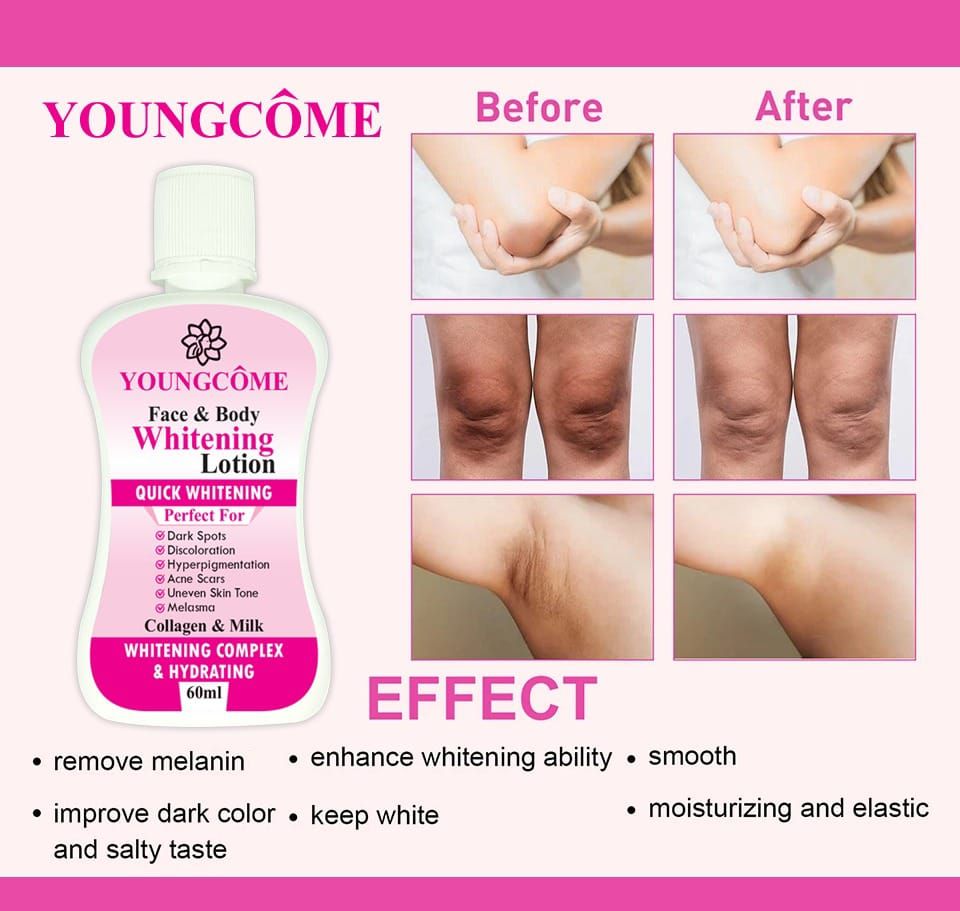 YOUNGCOME 60ml Face Body Whitening Lotion Underarm Brightening Private Underarm Body Cream Legs Whitening Parts View Gallery - Pakistan