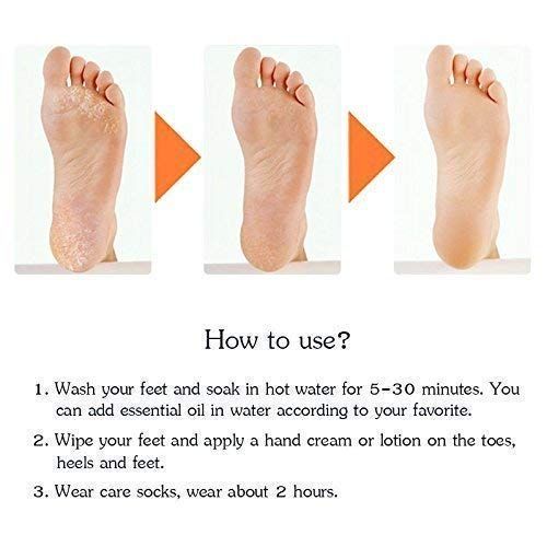1 Pair unisex silicone gel socks moisturizing sock breathable elastic heel cracked protector socks View Gallery - Pakistan
