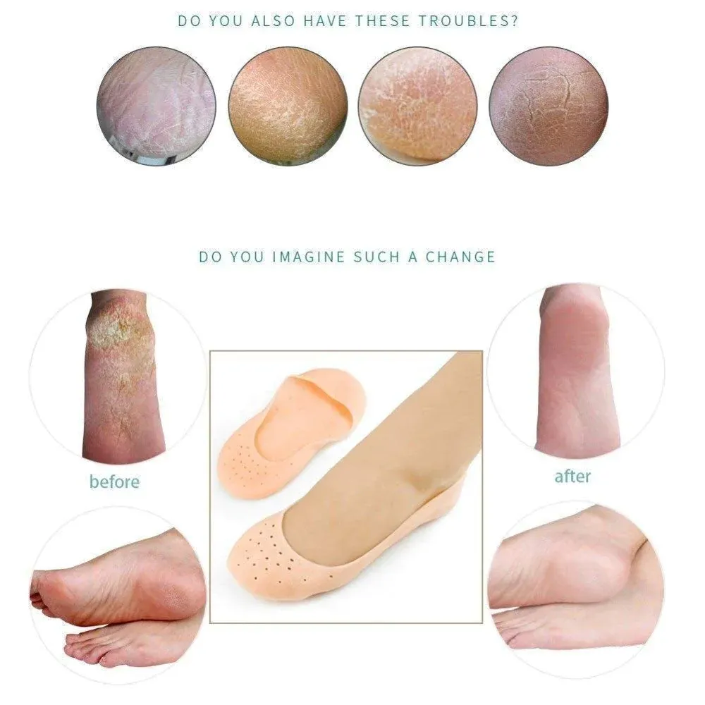 1 Pair unisex silicone gel socks moisturizing sock breathable elastic heel cracked protector socks View Gallery - Pakistan