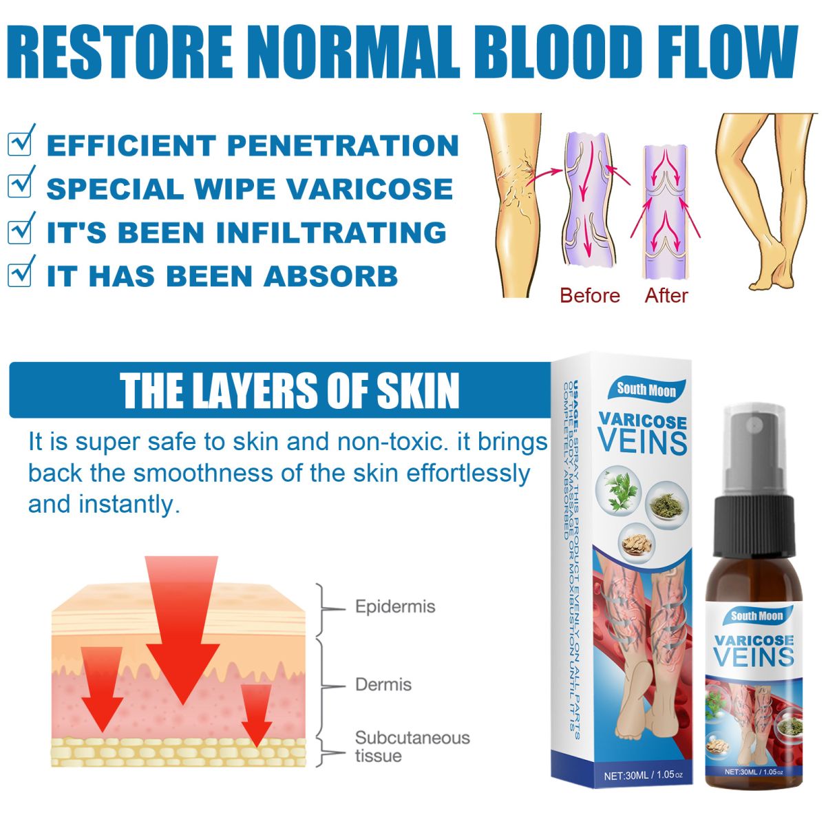 30ml Varicose Veins Treatment Spray Varicose Vein Treatment Cream Repair Varicocele Removal Pain Relief Kidney Inflammation Legs Vein Health Care Spray View Gallery - Pakistan