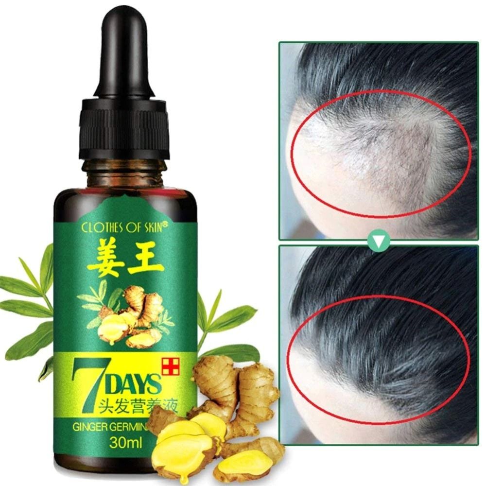 7 Day Ginger Germinal Oil Hair Nutrient Solution Hair Growth Essence Liquid Fast Natural Hair Loss Treatment Hair Care (30ml) View Gallery - Pakistan