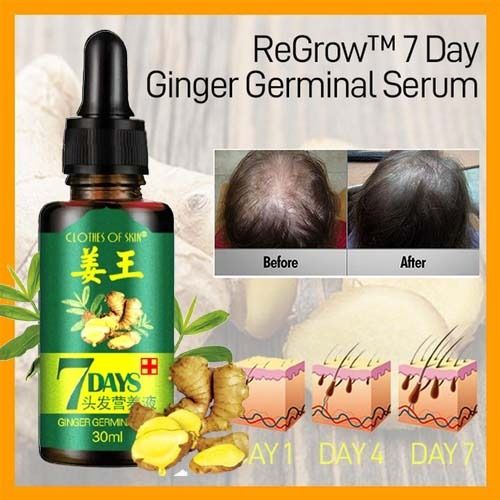 7 Day Ginger Germinal Oil Hair Nutrient Solution Hair Growth Essence Liquid Fast Natural Hair Loss Treatment Hair Care (30ml) View Gallery - Pakistan