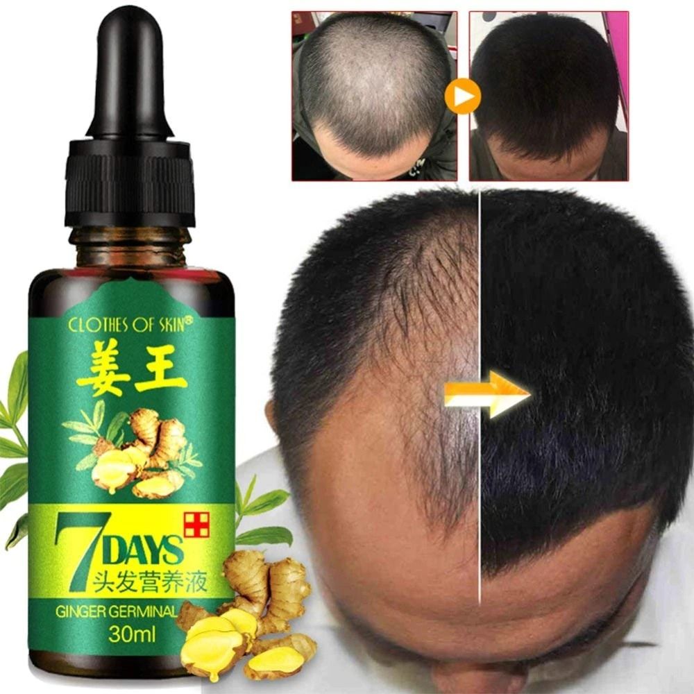 7 Day Ginger Germinal Oil Hair Nutrient Solution Hair Growth Essence Liquid Fast Natural Hair Loss Treatment Hair Care (30ml) View Gallery - Pakistan